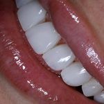 دکتر مهری صفری متخصص دندان پزشکی ترمیمی و زیبایی