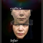 مرکزکلینیک لیزر زیبایی پوست و مو آسا