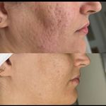 مرکز لیزر موهای زائد ماهور