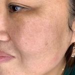 کلینیک فیشیال پوست صفا قم