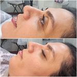 پاکسازی پوست و انواع فیشال تخصصی