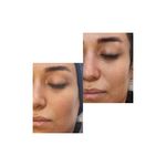 پاکسازی پوست و انواع فیشال تخصصی