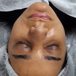 فیشال وپاکسازی پوست الماس آقا و خانم