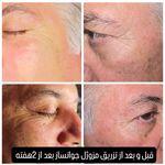 خدمات تخصصی فیشیال لیاناز اسکین هوم