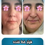 کلینیک زیبایی هانا