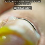 خدمات تخصصی_درمانی ناخن بهشاد داودی