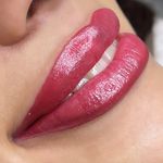 میکروکیماسی( میکروابرو چشم لب،ریمو)