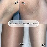 کلینیک زیبایی و لیزر نگین شرق