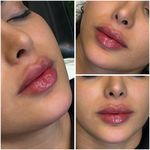 مجموعه لیزر و زیبایی کارنا(شاتی نداریم)