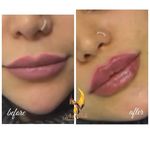 کلینیک زیبایی و مرکز لیزر هانیسا