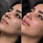کلینیک زیبایی و مرکز لیزر هانیسا