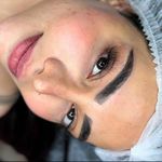 میکروبلیدینگ فیبروز تخصصی