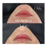 کلینیک زیبایی و لیزر مو زائد نوبا