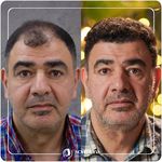 کلینیک پوست مو و زیبایی نوین ایرانا