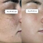 کلینیک پوست و مو بلانژ