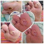 کارشناس زخم و متخصص کیوم تراپی بهرامی فر