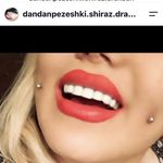 دکتر حسین اکبری دندانپزشک (زیبایی )
