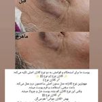 خدمات فیشال پاکسازی/اسکالپ اسکراپ ماهرخ