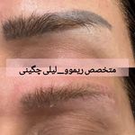 آرایش دائم، میکروپیگمنت، شید لب، خط چشم