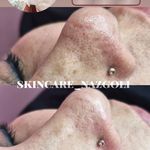 فیشال پوست نازگل