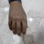 کلینیک پا و دست مصنوعی تهران