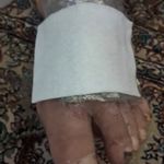 تزریقات پانسمان ویزیت در منزل تبریز نرس