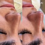 پاکسازی پوست و مو مهسام