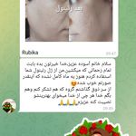 محصولات ارگانیک پوست ومو  حلزون