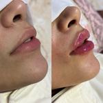 کیلینیک پوست مو زیبایی نیل