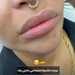 کلینیک زیبایی شایلی