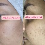 مرکز لیزر موهای زائد ماهور