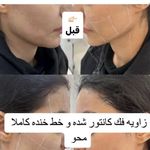 کلینیک زیبایی و لاغری شادرما