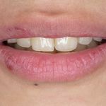 فتوگرافی پزشکی تکرنگ طب