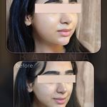 کلینیک پوست،مو، زیبایی و لیزر بارانا