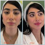 مطب زیبایی دکتر سیده زهرا حسینی