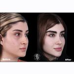 دکتر بهروز جلالی (جراحی بینی لیفت صورت)
