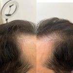 مرکز تخصصی مو و پوست سر مهسا میررحیمی