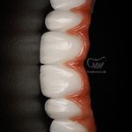 لابراتوار دندانسازی آراد نوین