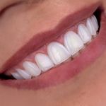 کلینیک‌دندانپزشکی دنتال آرنا-بیمه نیستیم