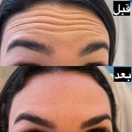کلینیک پوست و مو الیزا