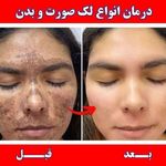 درمان تخصصی انواع عارضه پوست و مو