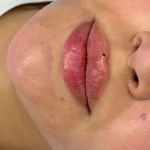 کلینیک زیبایی و لیزر لوتوس
