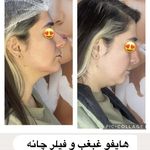 کلینیک زیبایی پوست و مو موژا مظفری