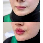 کلینیک زیبایی حس خوب