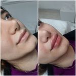 مرکز تخصصی لیزر