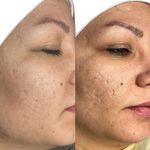 آموزش و خدمات پوست و فیشال رویا باقریان