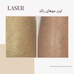 مرکز لیزر ،پوست و زیبایی کندی بیوتی
