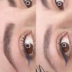 میکروبلیدینگ و شیدینگ مینا حسینی