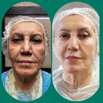 مطب پوست ،مو و لیزر یسنا طب