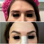 دکتر محمود قهقایی فوق تخصص جراحی پلاستیک